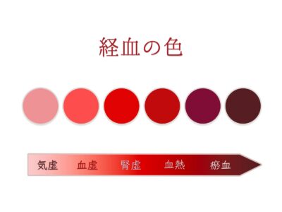 無月経の鍼灸・写真3