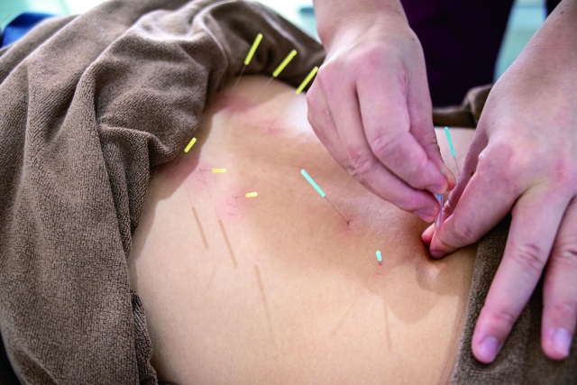置鍼時間・写真3