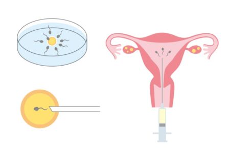 抗精子抗体の鍼灸・写真1｜鎌ケ谷・松戸・船橋