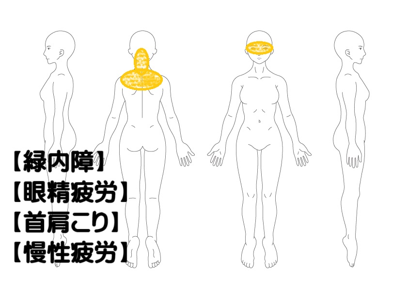 緑内障の鍼灸・写真1