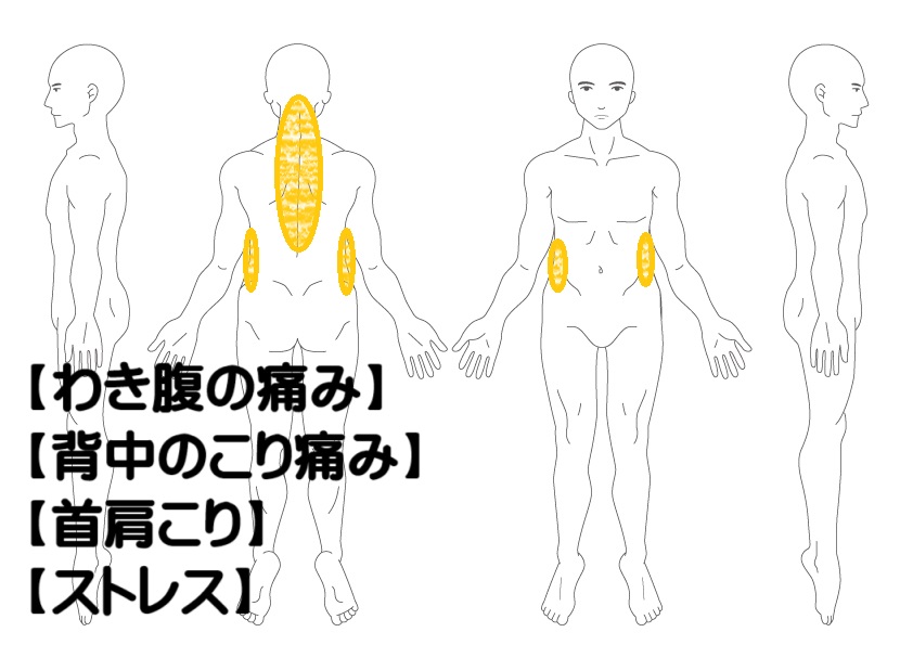 わき腹の痛みへの鍼灸症例・写真1