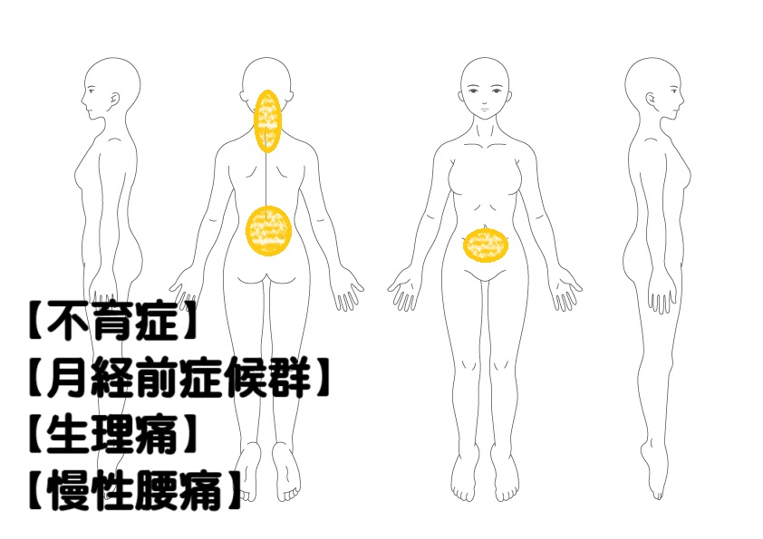 不育症への鍼灸症例・写真1