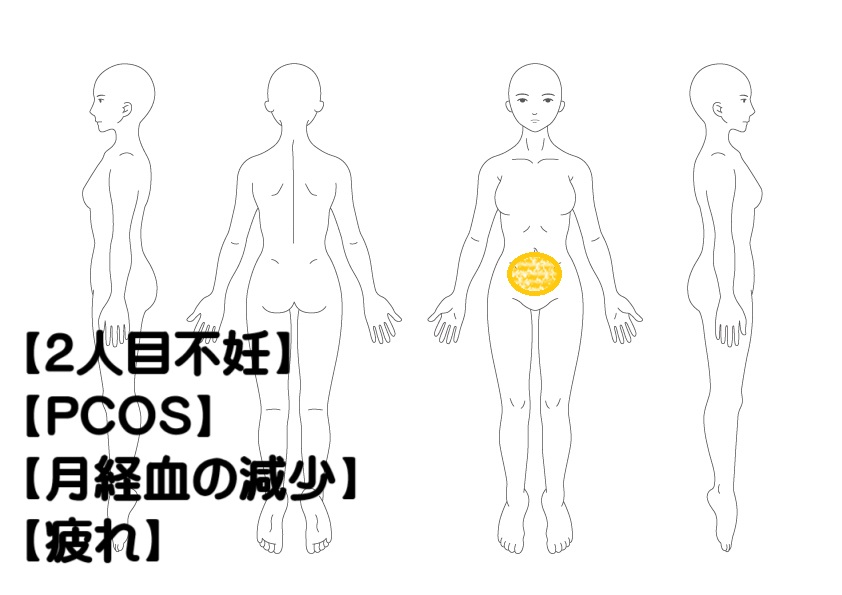 2人目不妊の鍼灸症例・写真1