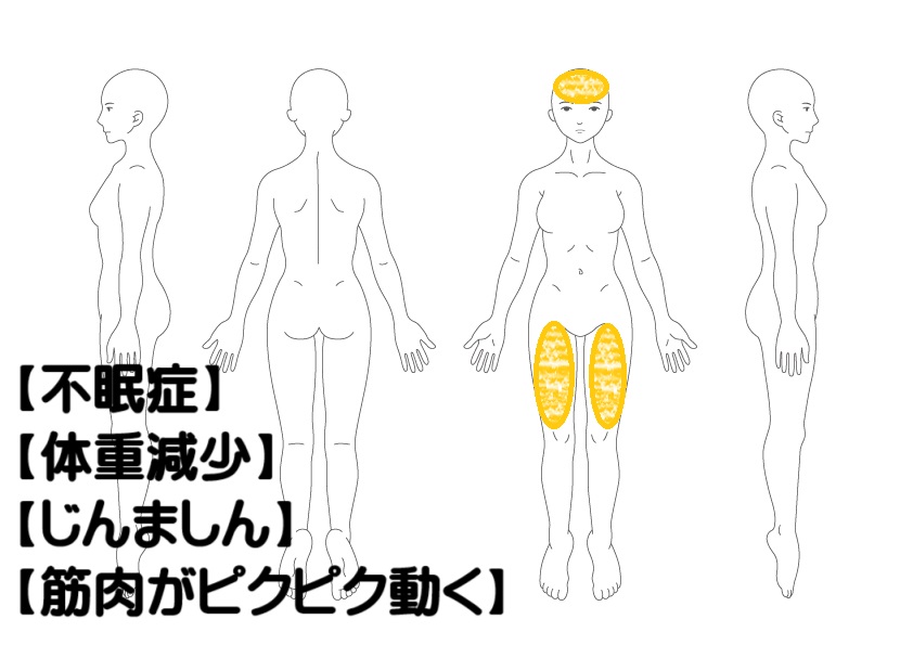 不眠症への鍼灸症例・写真1