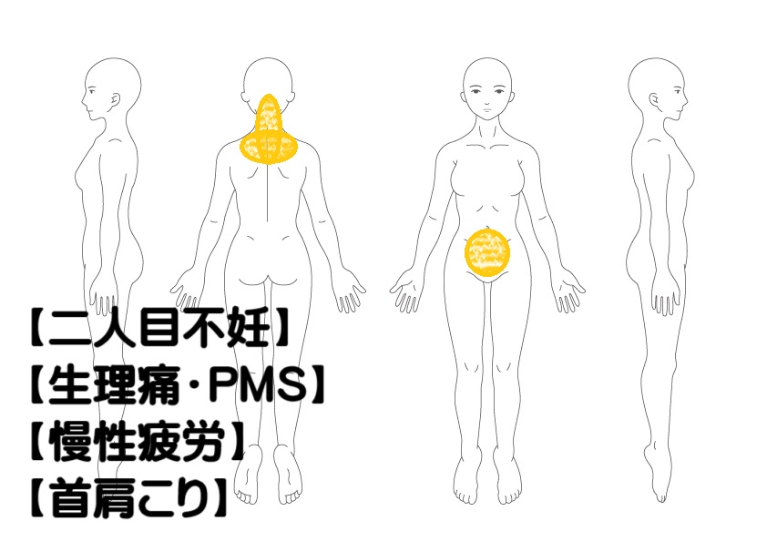二人目不妊への鍼灸症例・写真1