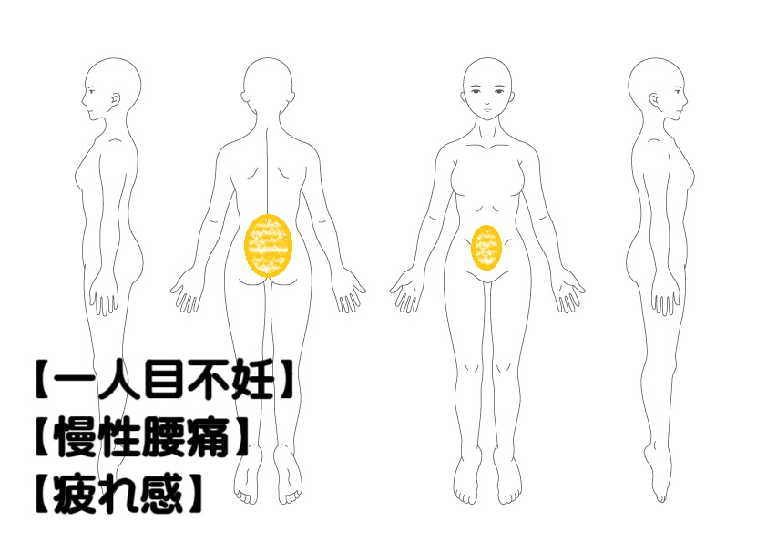 不妊鍼灸の症例・写真1