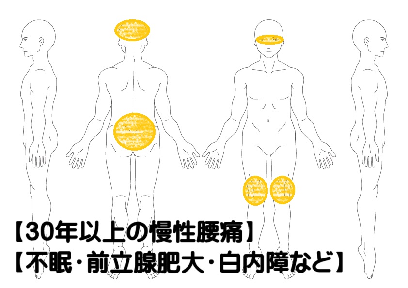 慢性腰痛の鍼灸症例・写真1