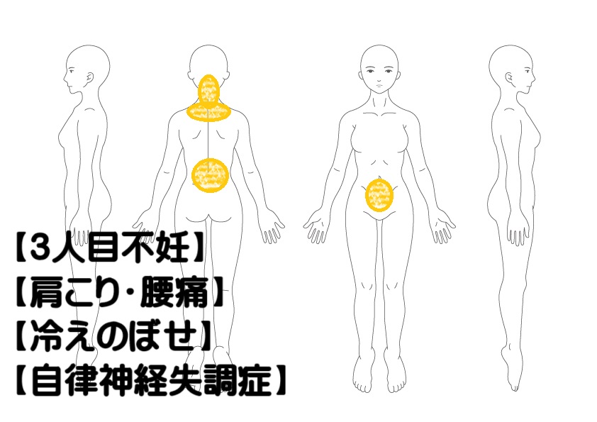3人目不妊への鍼灸症例・写真1