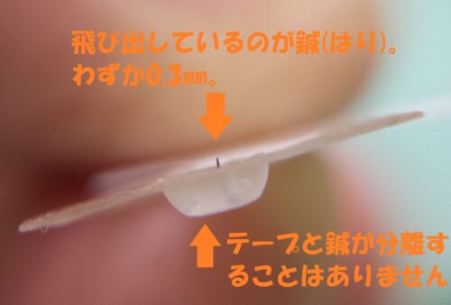 円皮鍼・写真0