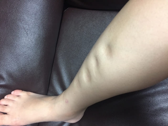 むくみに効くツボ・写真1