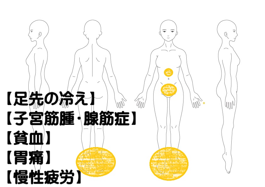 足の冷えへの鍼灸症例・写真1
