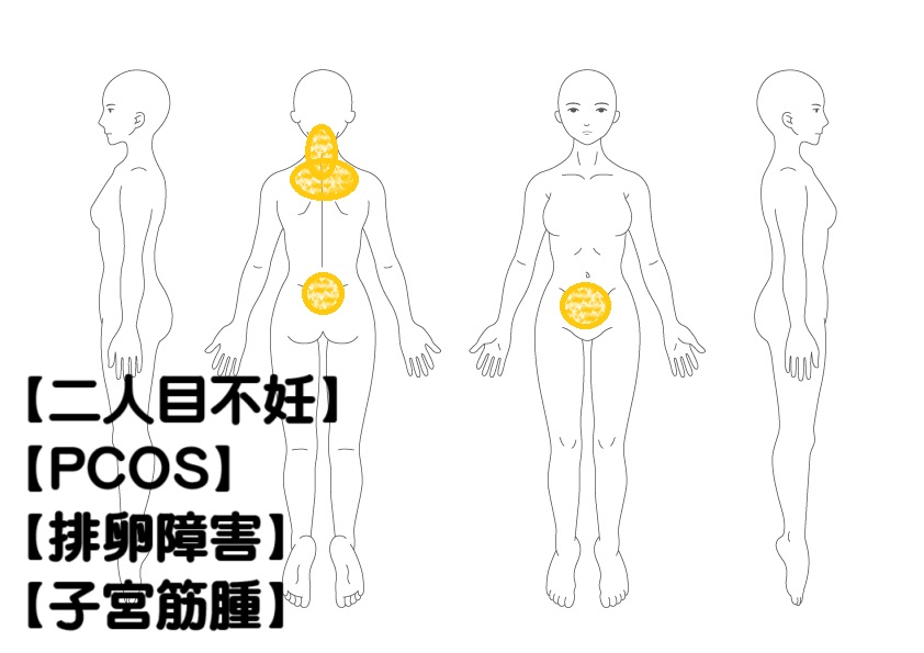 二人目不妊の鍼灸症例・写真1
