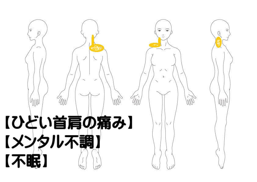首肩の痛みへの鍼灸症例・写真1