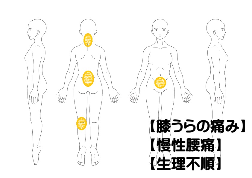 膝痛への鍼灸症例・写真1