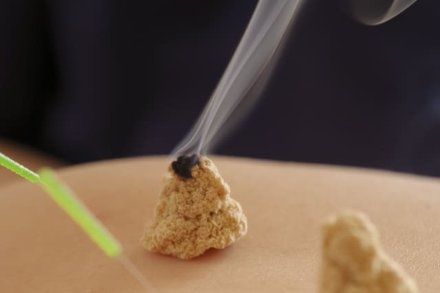 お灸の使い分け・写真1