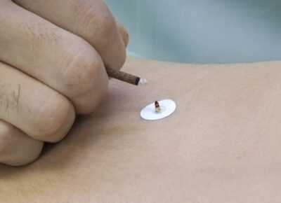 すえるお灸・写真