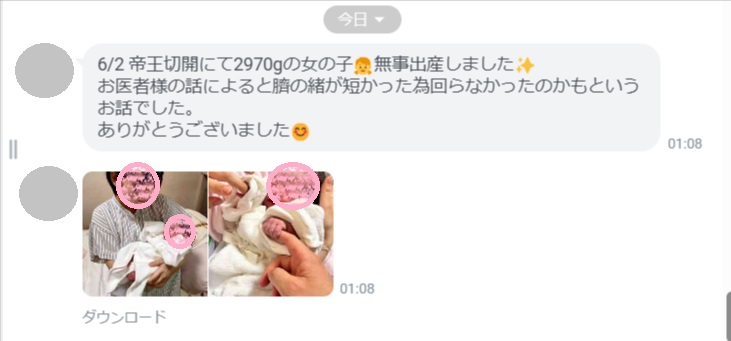 帝王切開にて2,970gの女の子を無事に出産 帝王切開にて2,970gの女の子を無事に出産