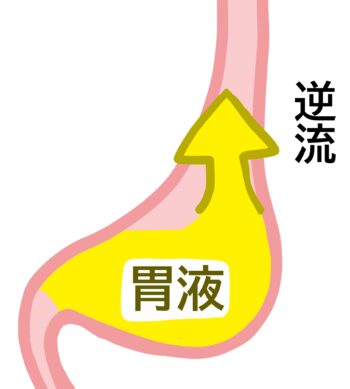 逆流性食道炎に効くツボ・写真2