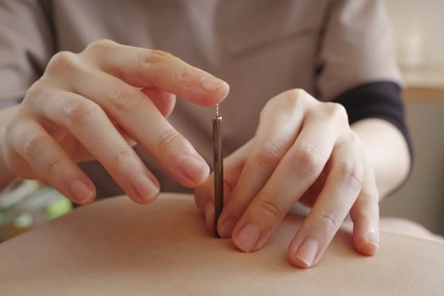 プラセボ効果と鍼灸・写真1