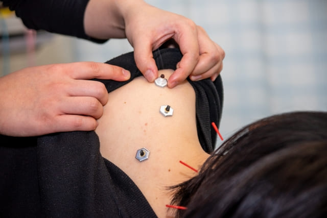 肩こりからくる吐き気めまい・写真8