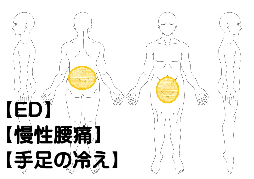 ＥＤ（勃起不全）への鍼灸症例
