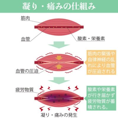 鍼でビクッとなる・写真2