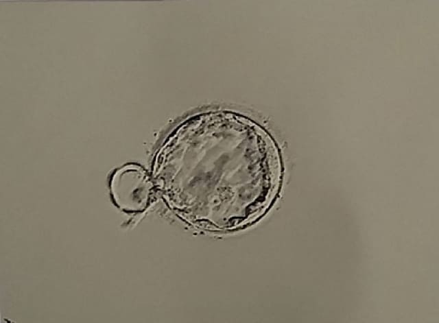 移植してもうまくいかない・写真2