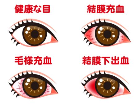 目の充血に効くツボ・写真2