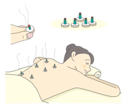 お灸で整える・写真1