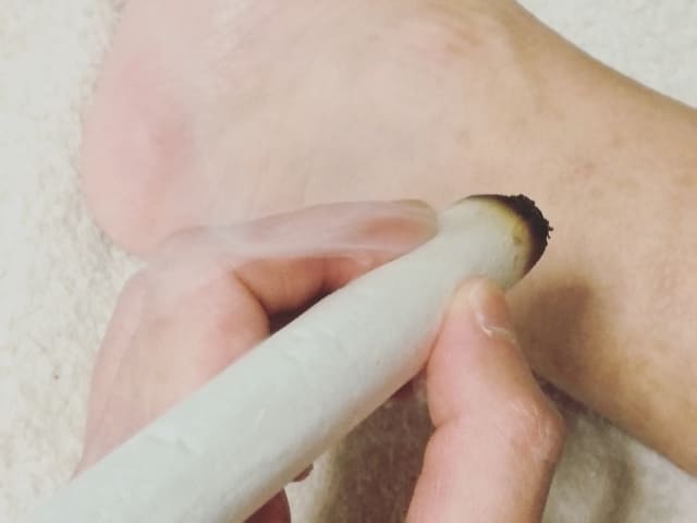 お灸入門・写真5