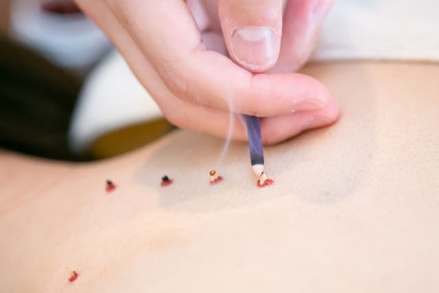 お灸入門・写真4